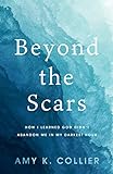 Beyond the Scars: How I Learned God Didn’t...
